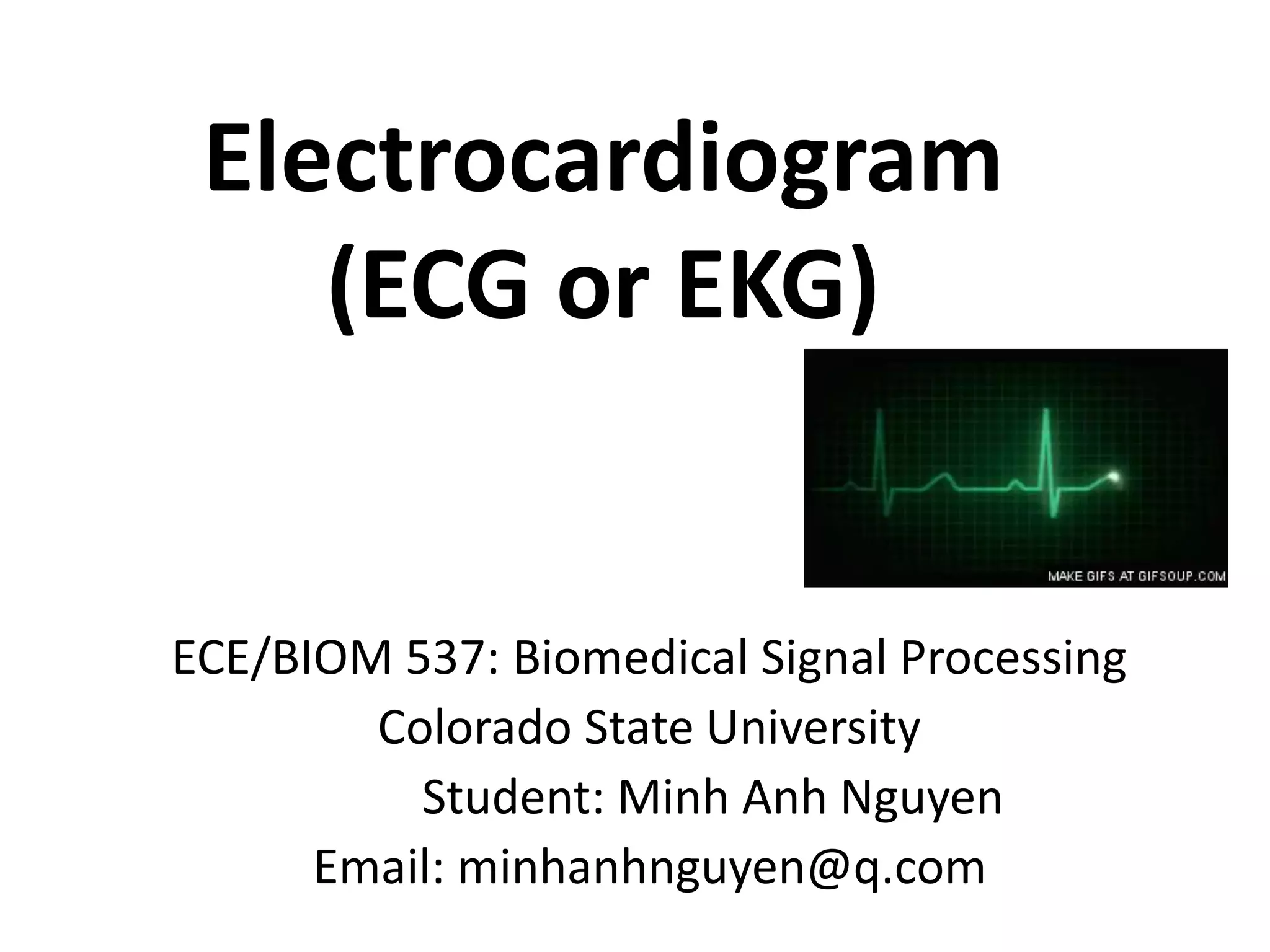Electrocardiogram (ECG or EKG) | PPTX