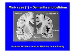 Mini- case (1) – Dementia and delirium




 Dr Adam Feather – Lead for Medicine for the Elderly
 