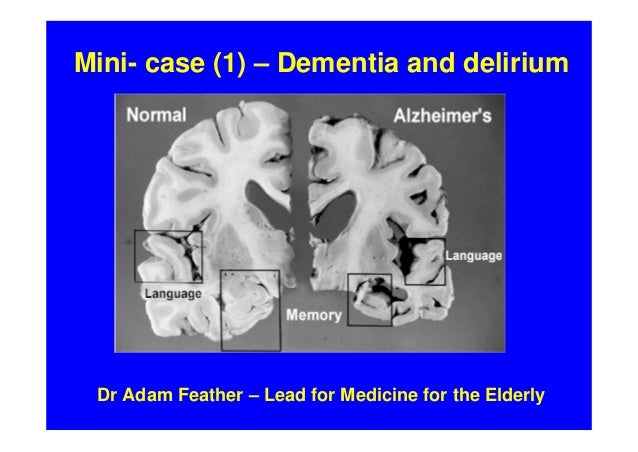 ati video case study dementia and delirium