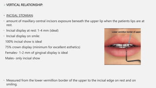 VERTICAL RELATIONSHIP:
 INCISAL STOMIAN:
• amount of maxillary central incisors exposure beneath the upper lip when the patients lips are at
rest.
• Incisal display at rest: 1-4 mm (ideal)
• Incisal display on smile:
100% incisal show is ideal
75% crown display (minimum for excellent esthetics)
Females- 1-2 mm of gingival display is ideal
Males- only incisal show
• Measured from the lower vermillion border of the upper to the incisal edge on rest and on
smiling.
 
