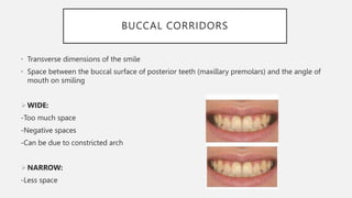 BUCCAL CORRIDORS
• Transverse dimensions of the smile
• Space between the buccal surface of posterior teeth (maxillary premolars) and the angle of
mouth on smiling
WIDE:
-Too much space
-Negative spaces
-Can be due to constricted arch
NARROW:
-Less space
 