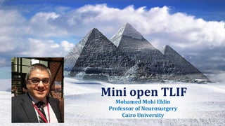 Mohamed Mohi Eldin
Professor of Neurosurgery
Cairo University
Mini open TLIF
 
