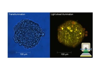 Miniaturized light sheet based fluorescence microscopy Schneckenburger