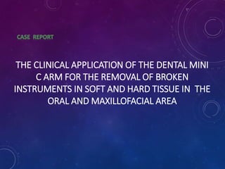 THE CLINICAL APPLICATION OF THE DENTAL MINI 
C ARM FOR THE REMOVAL OF BROKEN 
INSTRUMENTS IN SOFT AND HARD TISSUE IN THE 
ORAL AND MAXILLOFACIAL AREA 
 
