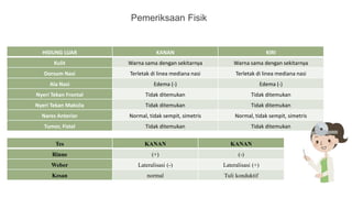Pemeriksaan Fisik
Tes KANAN KANAN
Rinne (+) (-)
Weber Lateralisasi (-) Lateralisasi (+)
Kesan normal Tuli konduktif
HIDUNG LUAR KANAN KIRI
Kulit Warna sama dengan sekitarnya Warna sama dengan sekitarnya
Dorsum Nasi Terletak di linea mediana nasi Terletak di linea mediana nasi
Ala Nasi Edema (-) Edema (-)
Nyeri Tekan Frontal Tidak ditemukan Tidak ditemukan
Nyeri Tekan Maksila Tidak ditemukan Tidak ditemukan
Nares Anterior Normal, tidak sempit, simetris Normal, tidak sempit, simetris
Tumor, Fistel Tidak ditemukan Tidak ditemukan
 