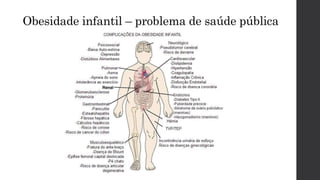 Obesidade infantil – problema de saúde pública
 