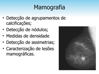 Mamografia
• Detecção de agrupamentos de
  calcificações;
• Detecção de nódulos;
• Medidas de densidade
• Detecção de assimetrias;
• Caracterização de lesões
  mamográficas.
 