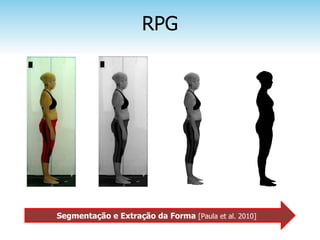 RPG




Segmentação e Extração da Forma [Paula et al. 2010]
 