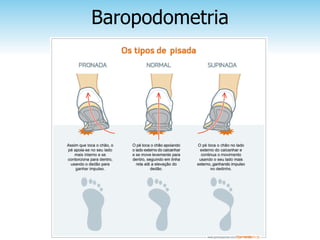 Baropodometria
 