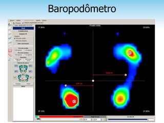 Baropodômetro
 