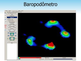 Baropodômetro
 