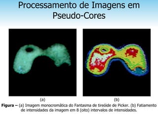 Processamento de Imagens em
                 Pseudo-Cores




                     (a)                                      (b)
Figura – (a) Imagem monocromática do Fantasma de tireóide de Picker. (b) Fatiamento
          de intensidades da imagem em 8 (oito) intervalos de intensidades.
 