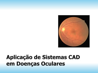 Aplicação de Sistemas CAD
em Doenças Oculares
 