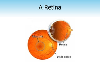 A Retina
 