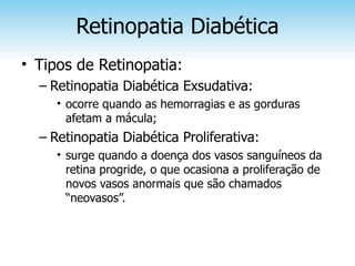 Retinopatia Diabética
• Tipos de Retinopatia:
  – Retinopatia Diabética Exsudativa:
     • ocorre quando as hemorragias e as gorduras
       afetam a mácula;
  – Retinopatia Diabética Proliferativa:
     • surge quando a doença dos vasos sanguíneos da
       retina progride, o que ocasiona a proliferação de
       novos vasos anormais que são chamados
       “neovasos”.
 
