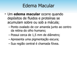 Edema Macular
• Um edema macular ocorre quando
  depósitos de fluidos e proteínas se
  acumulam sobre ou sob a mácula;
  – Ponto ovalado de cor amarela junto ao centro
    da retina do olho humano;
  – Possui cerca de 1,5 mm de diâmetro;
  – Apresenta uma pigmentação escura;
  – Sua região central é chamada fóvea.
 