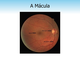 A Mácula
 