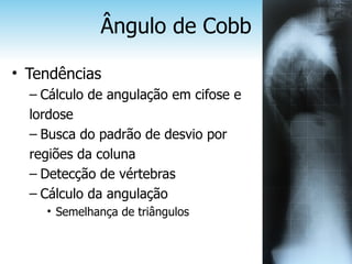 Ângulo de Cobb

• Tendências
  – Cálculo de angulação em cifose e
  lordose
  – Busca do padrão de desvio por
  regiões da coluna
  – Detecção de vértebras
  – Cálculo da angulação
    • Semelhança de triângulos
 