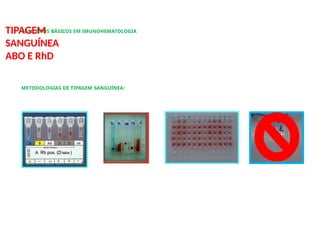 CONCEITOS BÁSICOS EM IMUNOHEMATOLOGIA
TIPAGEM
SANGUÍNEA
ABO E RhD
METODOLOGIAS DE TIPAGEM SANGUÍNEA:
 