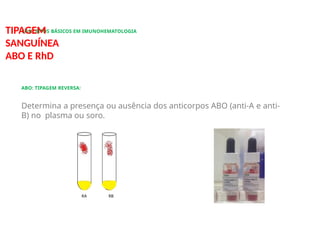 CONCEITOS BÁSICOS EM IMUNOHEMATOLOGIA
TIPAGEM
SANGUÍNEA
ABO E RhD
ABO: TIPAGEM REVERSA:
Determina a presença ou ausência dos anticorpos ABO (anti-A e anti-
B) no plasma ou soro.
RA RB
 