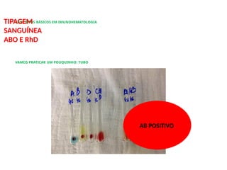 CONCEITOS BÁSICOS EM IMUNOHEMATOLOGIA
TIPAGEM
SANGUÍNEA
ABO E RhD
VAMOS PRATICAR UM POUQUINHO: TUBO
AB POSITIVO
 