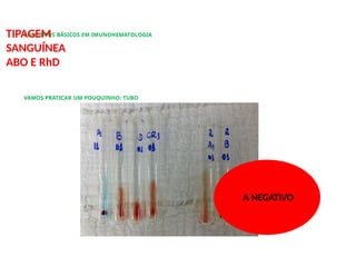 CONCEITOS BÁSICOS EM IMUNOHEMATOLOGIA
TIPAGEM
SANGUÍNEA
ABO E RhD
VAMOS PRATICAR UM POUQUINHO: TUBO
A NEGATIVO
 