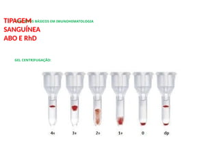 CONCEITOS BÁSICOS EM IMUNOHEMATOLOGIA
TIPAGEM
SANGUÍNEA
ABO E RhD
GEL CENTRIFUGAÇÃO:
 
