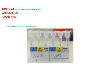 CONCEITOS BÁSICOS EM IMUNOHEMATOLOGIA
TIPAGEM
SANGUÍNEA
ABO E RhD
VAMOS PRATICAR UM POUQUINHO: GEL
 