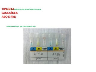 CONCEITOS BÁSICOS EM IMUNOHEMATOLOGIA
TIPAGEM
SANGUÍNEA
ABO E RhD
VAMOS PRATICAR UM POUQUINHO: GEL
 