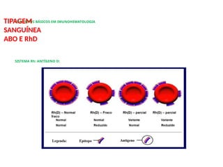 CONCEITOS BÁSICOS EM IMUNOHEMATOLOGIA
TIPAGEM
SANGUÍNEA
ABO E RhD
SISTEMA Rh: ANTÍGENO D:
 