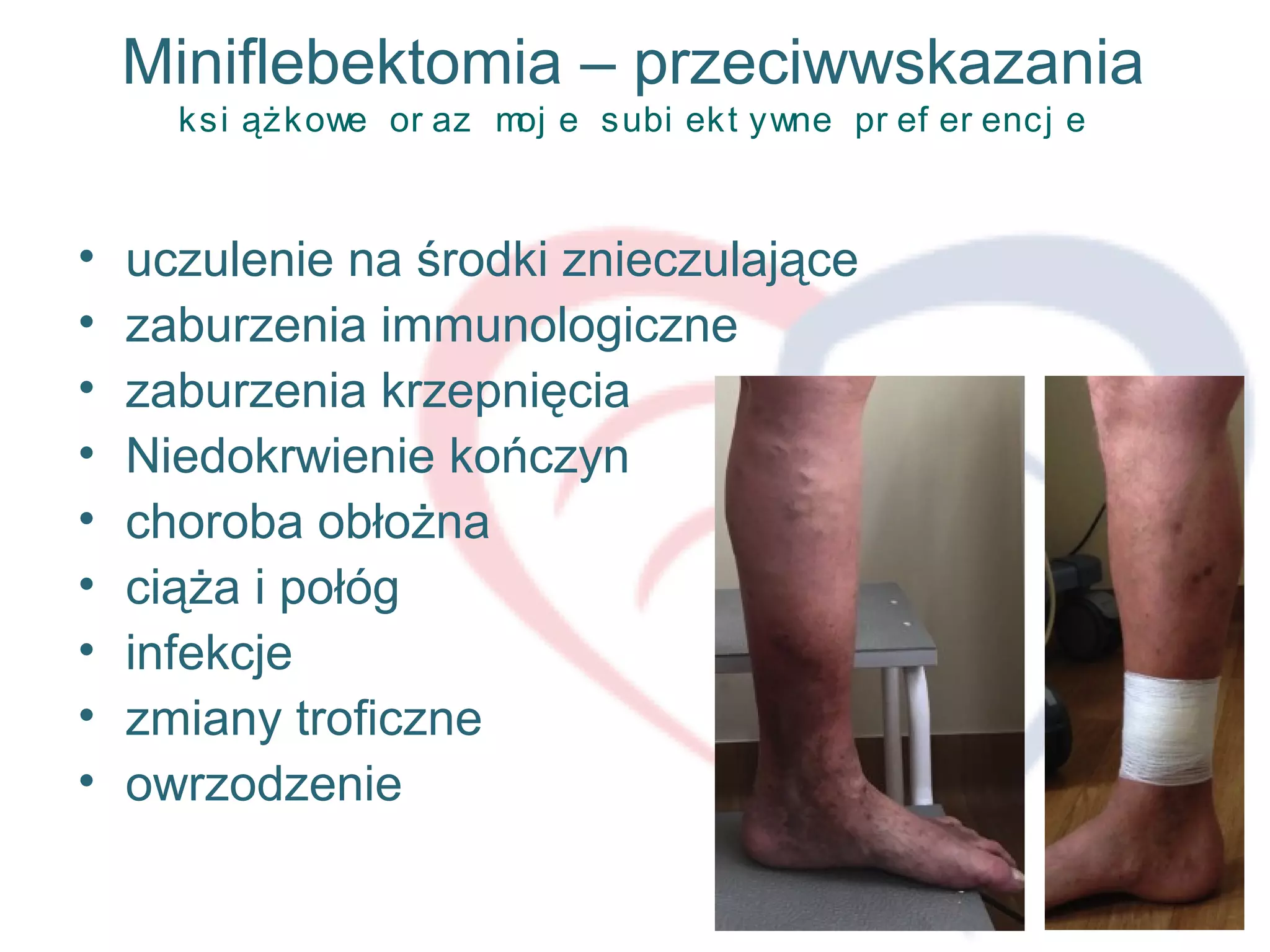 Miniflebektomia – przeciwwskazania
ksi ążkowe or az moj e subi ekt ywne pr ef er encj e
• uczulenie na środki znieczulające
• zaburzenia immunologiczne
• zaburzenia krzepnięcia
• Niedokrwienie kończyn
• choroba obłożna
• ciąża i połóg
• infekcje
• zmiany troficzne
• owrzodzenie
 