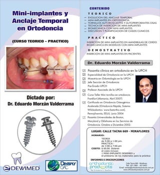 Mini Implantes y Anclaje Temporal en Ortodoncia