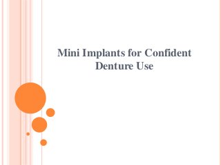 Mini Implants for Confident
Denture Use
 