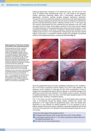 Minilaparoscopy cholecystectomy and hernia repair | PDF