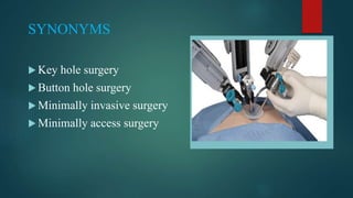 SYNONYMS
 Key hole surgery
 Button hole surgery
 Minimally invasive surgery
 Minimally access surgery
 