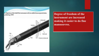 Degree of freedom of the
instrument are increased
making it easier to do fine
manoeuvres.
 