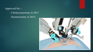 Approved for :-
- Cholecystectomy in 2011
- Hysterectomy in 2013
 