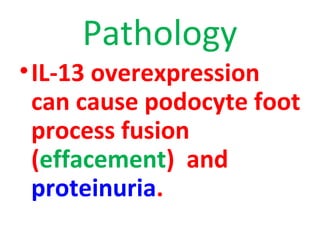 Pathology
•IL-13 overexpression
can cause podocyte foot
process fusion
(effacement) and
proteinuria.
 