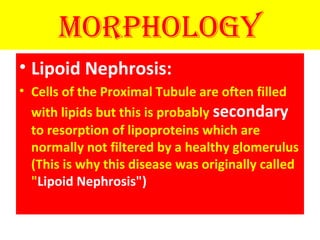 Morphology
• Lipoid Nephrosis:
• Cells of the Proximal Tubule are often filled
with lipids but this is probably secondary
to resorption of lipoproteins which are
normally not filtered by a healthy glomerulus
(This is why this disease was originally called
"Lipoid Nephrosis")
 