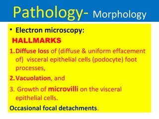 Pathology- Morphology
• Electron microscopy:
HALLMARKS
1.Diffuse loss of (diffuse & uniform effacement
of) visceral epithelial cells (podocyte) foot
processes,
2.Vacuolation, and
3. Growth of microvilli on the visceral
epithelial cells.
Occasional focal detachments.
 