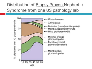 Distribution of Biopsy Proven Nephrotic
Syndrome from one US pathology lab
 