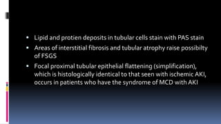  Lipid and protien deposits in tubular cells stain with PAS stain
 Areas of interstitial fibrosis and tubular atrophy raise possibilty
of FSGS
 Focal proximal tubular epithelial flattening (simplification),
which is histologically identical to that seen with ischemic AKI,
occurs in patients who have the syndrome of MCD with AKI
 