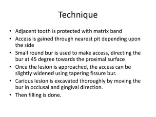 Minimal Intervention Dentistry.pptx