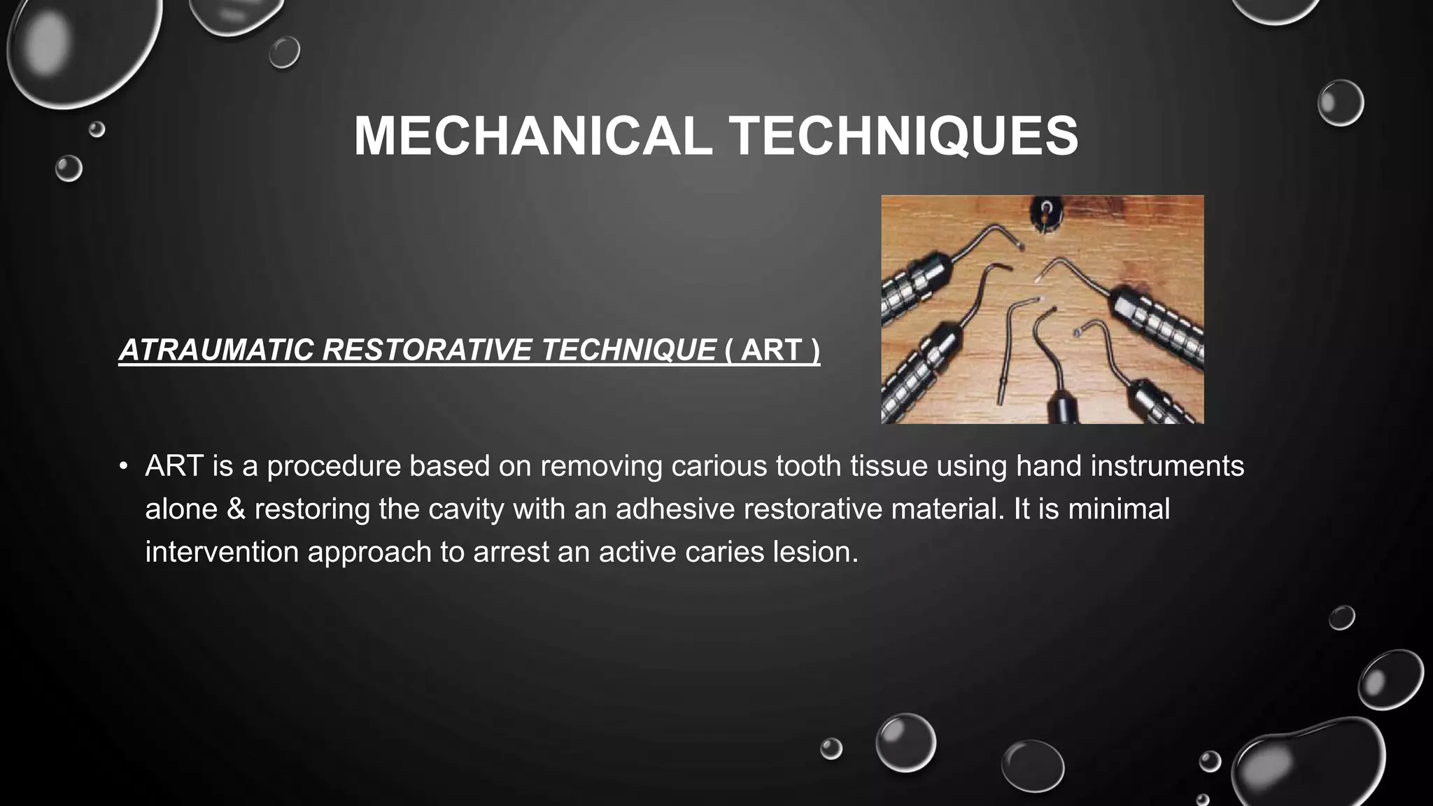 Minimal invasive dentistry | PPTX