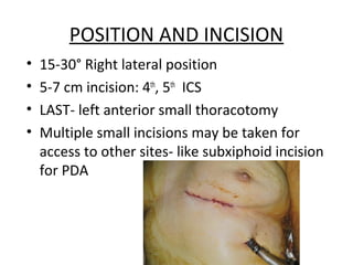 Minimal invasive cabg | PPT