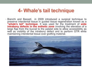4- Whale’s tail technique
• Bianchi and Basseti in 2009 introduced a surgical technique to
preserve interdental tissue in guided tissue regeneration known as a
“whale’s tail” technique. It was used for the treatment of wide
intrabony defects in the esthetic zone involving the elevation of a
large flap from the buccal to the palatal side to allow accessibility as
well as visibility of the intrabony defect and to perform GTR while
maintaining interdental tissue over grafting material.
 