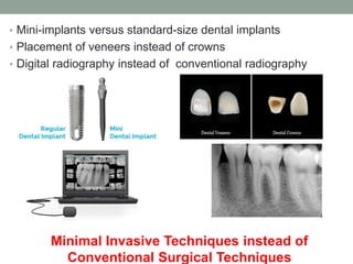 • Mini-implants versus standard-size dental implants
• Placement of veneers instead of crowns
• Digital radiography instead of conventional radiography
Minimal Invasive Techniques instead of
Conventional Surgical Techniques
 
