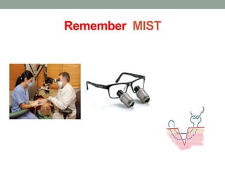 Remember MIST
 