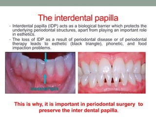 The interdental papilla
• Interdental papilla (IDP) acts as a biological barrier which protects the
underlying periodontal structures, apart from playing an important role
in esthetics.
• The loss of IDP as a result of periodontal disease or of periodontal
therapy leads to esthetic (black triangle), phonetic, and food
impaction problems.
This is why, it is important in periodontal surgery to
preserve the inter dental papilla.
 