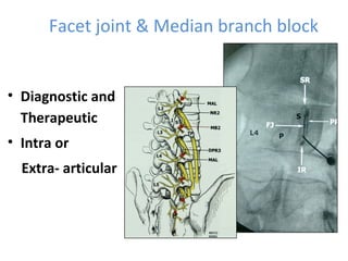 Lmnbb Minimal invasive techniques in lumbar degenerative diseases | PPT